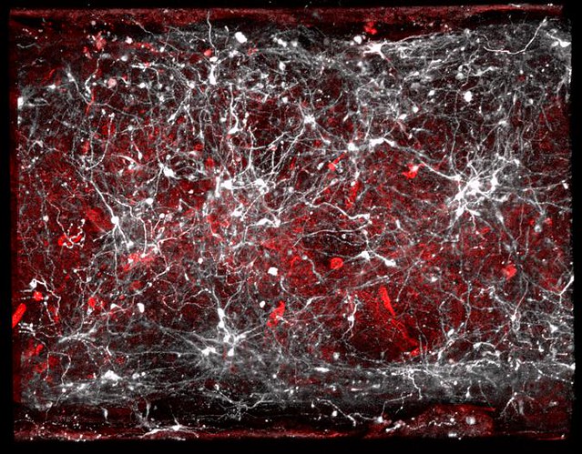 Brain Chip Vasculature cells and dopamine-producing neurons of the human brain, both generated from a patient’s stem cells in the Brain-Chip for research on Parkinson’s disease.